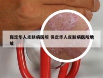 保定华人皮肤病医院 保定华人皮肤病医院地址