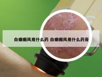 白癞癜风用什么药 白癞癜风用什么药膏