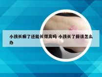 小孩长癣了还能长得高吗 小孩长了藓该怎么办