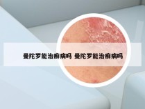 曼陀罗能治癣病吗 曼陀罗能治癣病吗