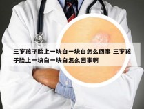 三岁孩子脸上一块白一块白怎么回事 三岁孩子脸上一块白一块白怎么回事啊