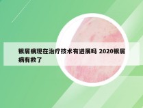 银屑病现在治疗技术有进展吗 2020银屑病有救了