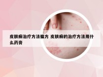 皮肤癣治疗方法偏方 皮肤癣的治疗方法用什么药膏