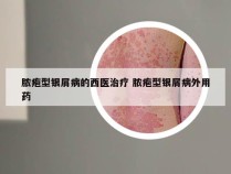 脓疱型银屑病的西医治疗 脓疱型银屑病外用药