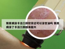 银屑病涂卡泊三醇软膏还可以涂甘油吗 银屑病涂了卡泊三醇越来越大