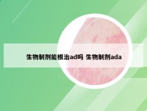 生物制剂能根治ad吗 生物制剂ada