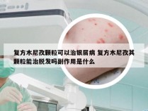 复方木尼孜颗粒可以治银屑病 复方木尼孜其颗粒能治脱发吗副作用是什么