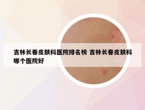 吉林长春皮肤科医院排名榜 吉林长春皮肤科哪个医院好