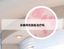 白癜风吃肽能治疗吗