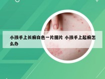 小孩手上长癣白色一片图片 小孩手上起癣怎么办