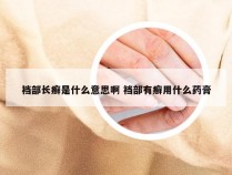 裆部长癣是什么意思啊 裆部有癣用什么药膏