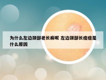 为什么左边颈部老长癣呢 左边颈部长痘痘是什么原因