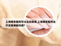 上海哪家医院可以治皮肤病 上海哪家医院治疗皮肤病最权威?