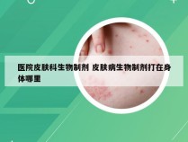 医院皮肤科生物制剂 皮肤病生物制剂打在身体哪里