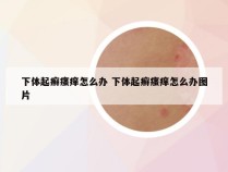 下体起癣瘙痒怎么办 下体起癣瘙痒怎么办图片