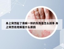 身上突然起了像癣一样的东西是怎么回事 身上突然出现癣是什么原因