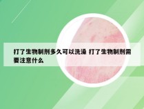 打了生物制剂多久可以洗澡 打了生物制剂需要注意什么