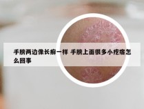 手膀两边像长癣一样 手膀上面很多小疙瘩怎么回事