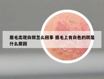 眉毛出现白斑怎么回事 眉毛上有白色的斑是什么原因