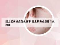 腿上起白点点怎么回事 腿上长白点点是什么回事