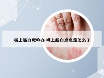 嘴上起白斑咋办 嘴上起白点点是怎么了