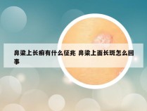 鼻梁上长癣有什么征兆 鼻梁上面长斑怎么回事