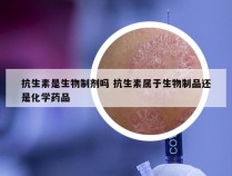 抗生素是生物制剂吗 抗生素属于生物制品还是化学药品