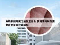 生物制剂用完之后复查什么 使用生物制剂需要定期复查什么指标