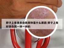 脖子上有很多白色斑块是什么原因 脖子上有好多白斑一块一块的