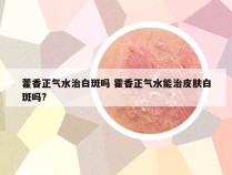 藿香正气水治白斑吗 霍香正气水能治皮肤白斑吗?