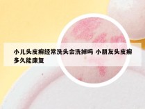 小儿头皮癣经常洗头会洗掉吗 小朋友头皮癣多久能康复