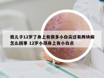 我儿子12岁了身上有很多小白尖还有两块癣怎么回事 12岁小孩身上有小白点