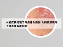 人的皮肤出现了白点什么原因 人的皮肤出现了白点什么原因呢