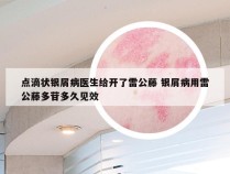 点滴状银屑病医生给开了雷公藤 银屑病用雷公藤多苷多久见效