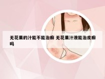 无花果的汁能不能治癣 无花果汁液能治皮癣吗