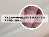 头皮上有一块白斑是怎么回事 头皮上有一块白斑是怎么回事儿