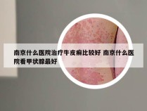 南京什么医院治疗牛皮癣比较好 南京什么医院看甲状腺最好