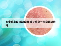 儿童脸上白块缺锌图 孩子脸上一块白是缺锌吗