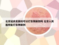 北京延庆皮肤科可以打生物制剂吗 北京人民医院能打生物制剂