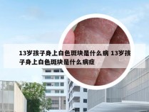 13岁孩子身上白色斑块是什么病 13岁孩子身上白色斑块是什么病症