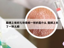 胳膊上有好几块像癣一样的是什么 胳膊上长了一块儿癣