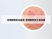 生物制剂多长起效 生物制剂多久有效果