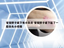 宝宝脖子底下有小白点 宝宝脖子底下起了一层白头小疙瘩