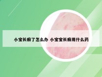 小宝长癣了怎么办 小宝宝长癣用什么药