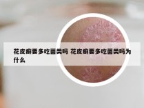 花皮癣要多吃菌类吗 花皮癣要多吃菌类吗为什么