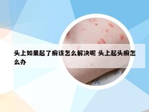 头上如果起了癣该怎么解决呢 头上起头癣怎么办