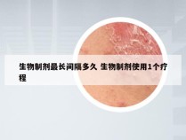 生物制剂最长间隔多久 生物制剂使用1个疗程