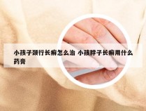 小孩子颈行长癣怎么治 小孩脖子长癣用什么药膏