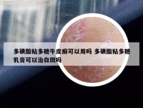 多磺酸粘多糖牛皮癣可以用吗 多磺酸粘多糖乳膏可以治白斑吗