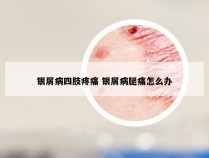 银屑病四肢疼痛 银屑病腿痛怎么办